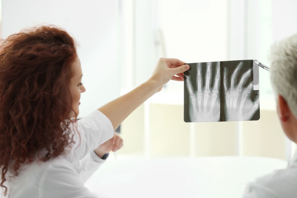 Arthritis How Effective Are X-Rays for Diagnosis (1)