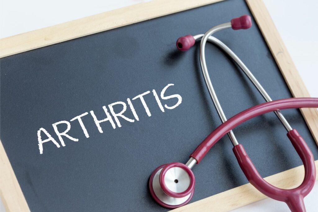 Arthritis In Your 30s Signs, Causes And Treatments Alpha Nutrition