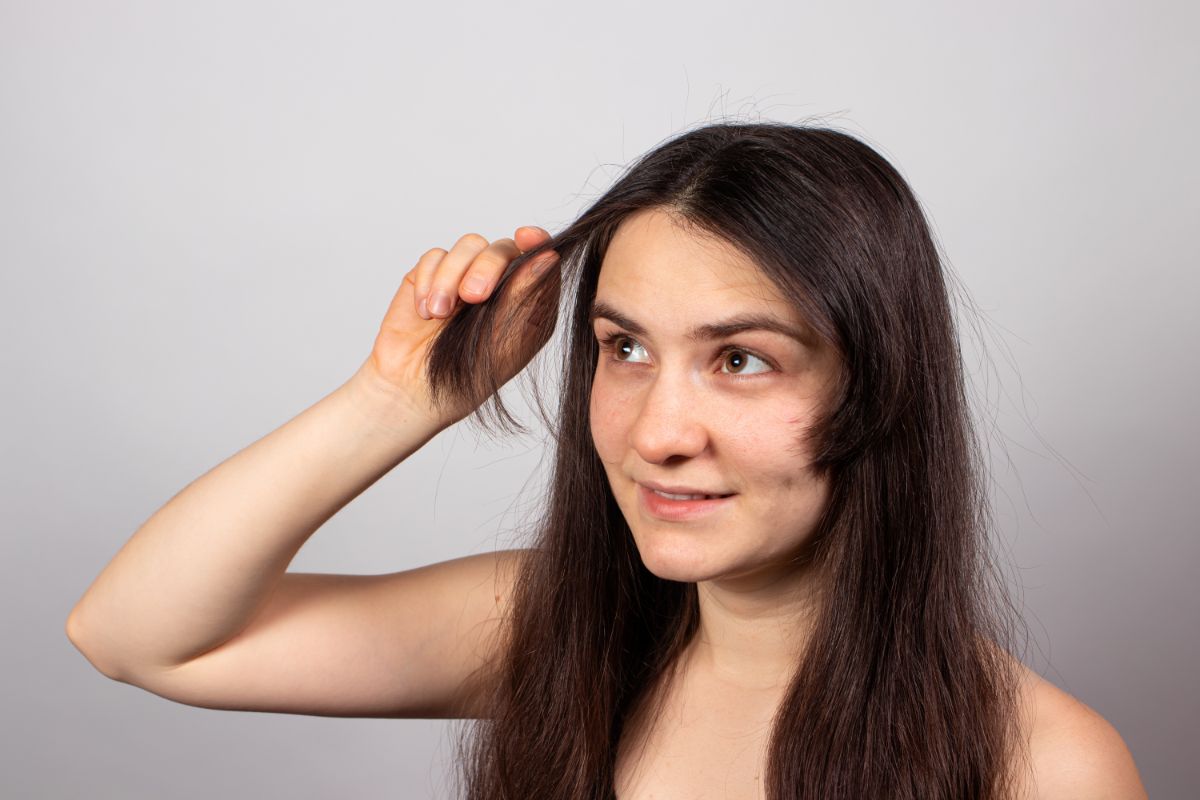 Can Psoriasis Affect Hair Growth? And How to Reduce Hair Loss