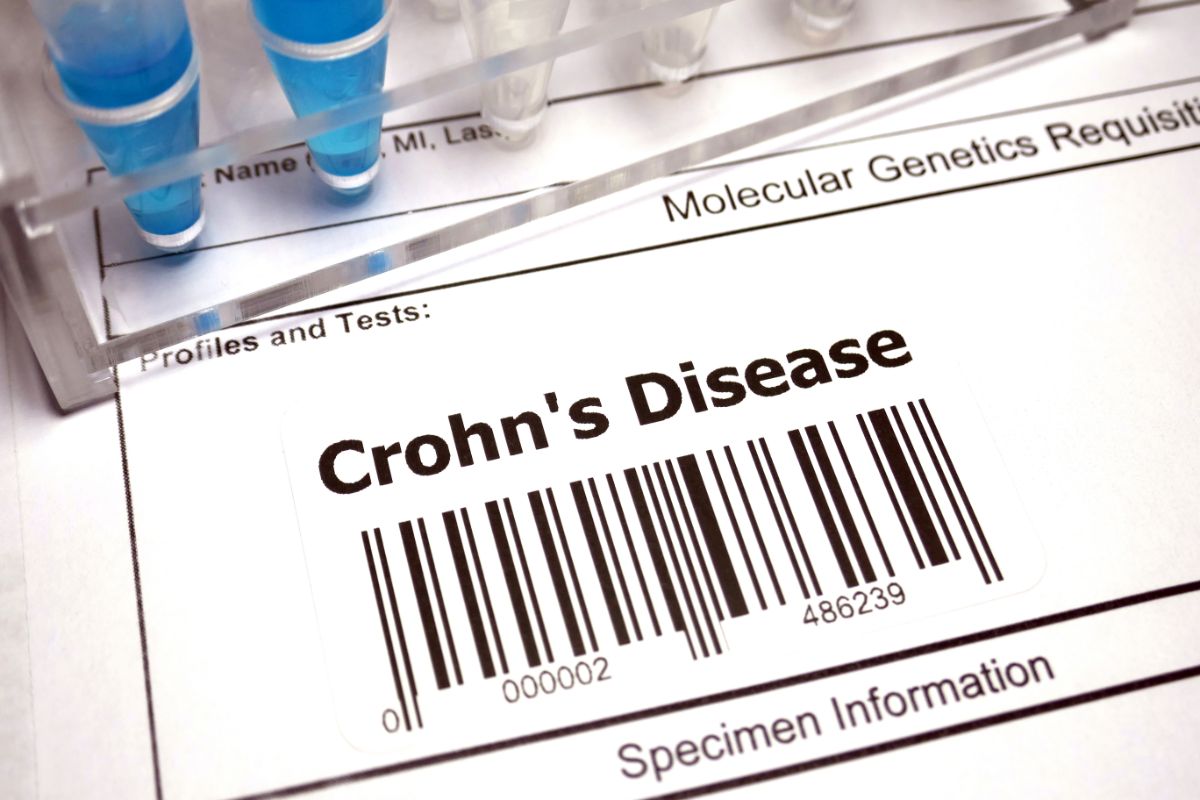 Crohn's Disease How Painful is it (And How to Manage the Pain)