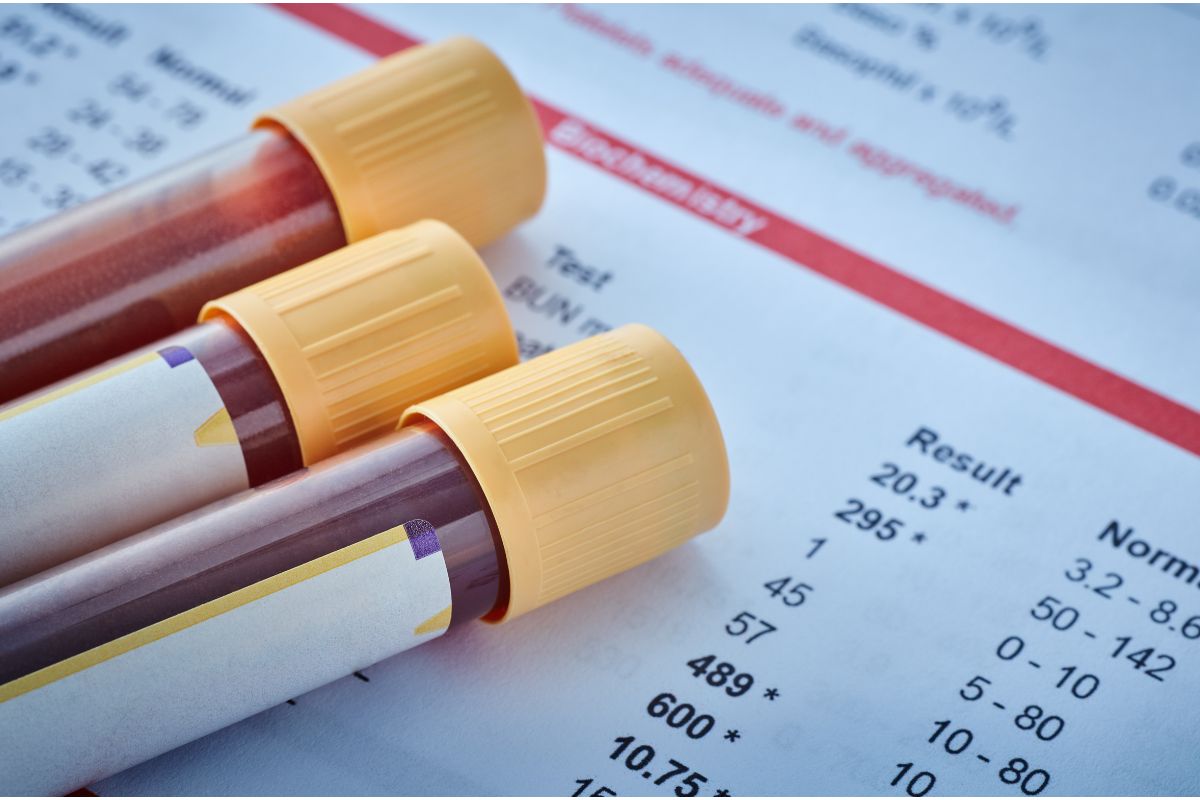 Diagnosing Heart Disease (All You Need To Know) 