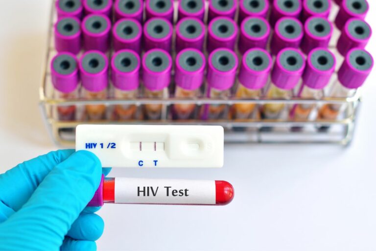 HIV Testing Types, Effectiveness And Availability Alpha Nutrition