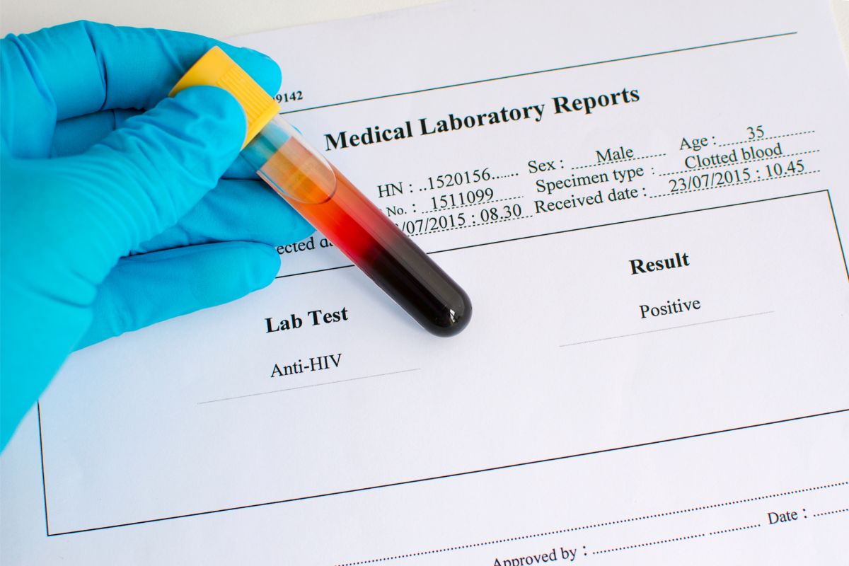 HIV What Are the 4 Stages of HIV Progression (1)