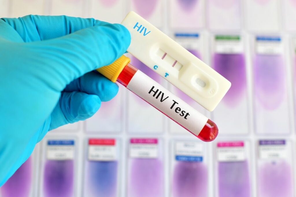 How Soon After Unprotected Sex Can I Test For Hiv Alpha Nutrition