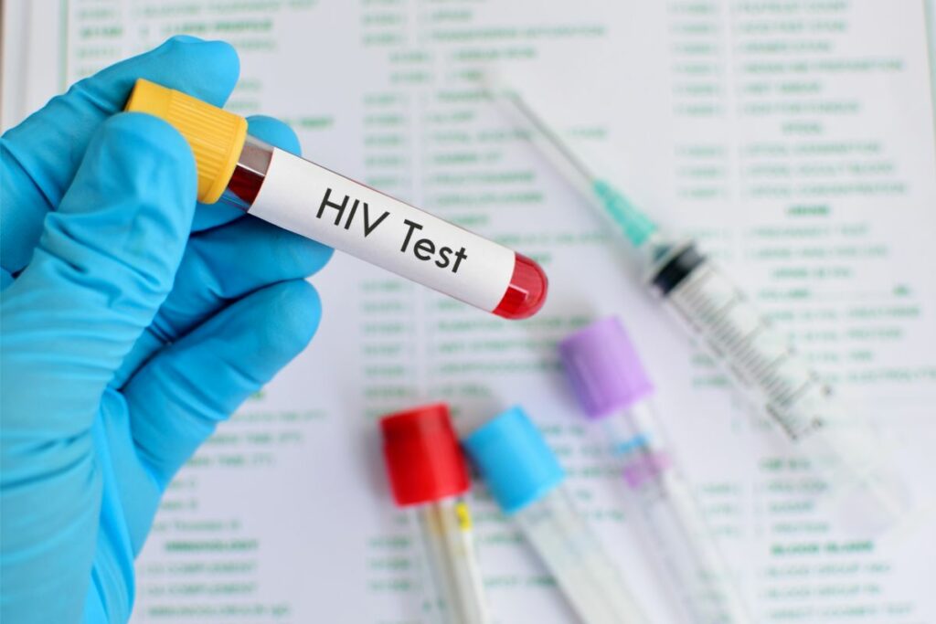 What Does Non Reactive HIV Test Mean Alpha Nutrition