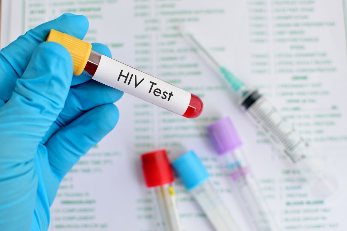 What Does Non-Reactive HIV Test Mean?