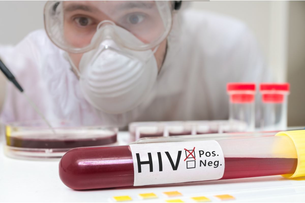 Why Is My HIV Test Taking So Long? 