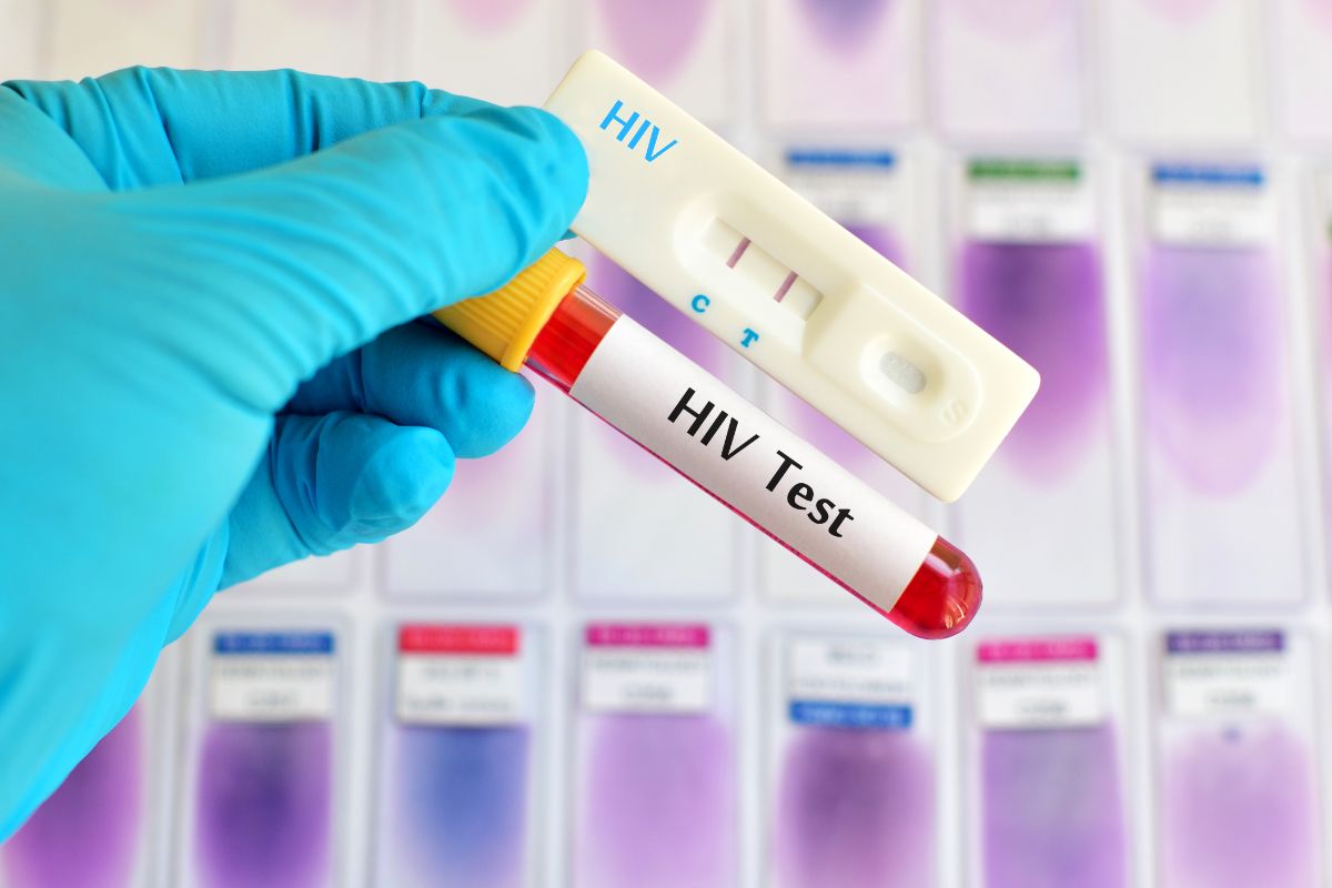 how much does an hiv test cost