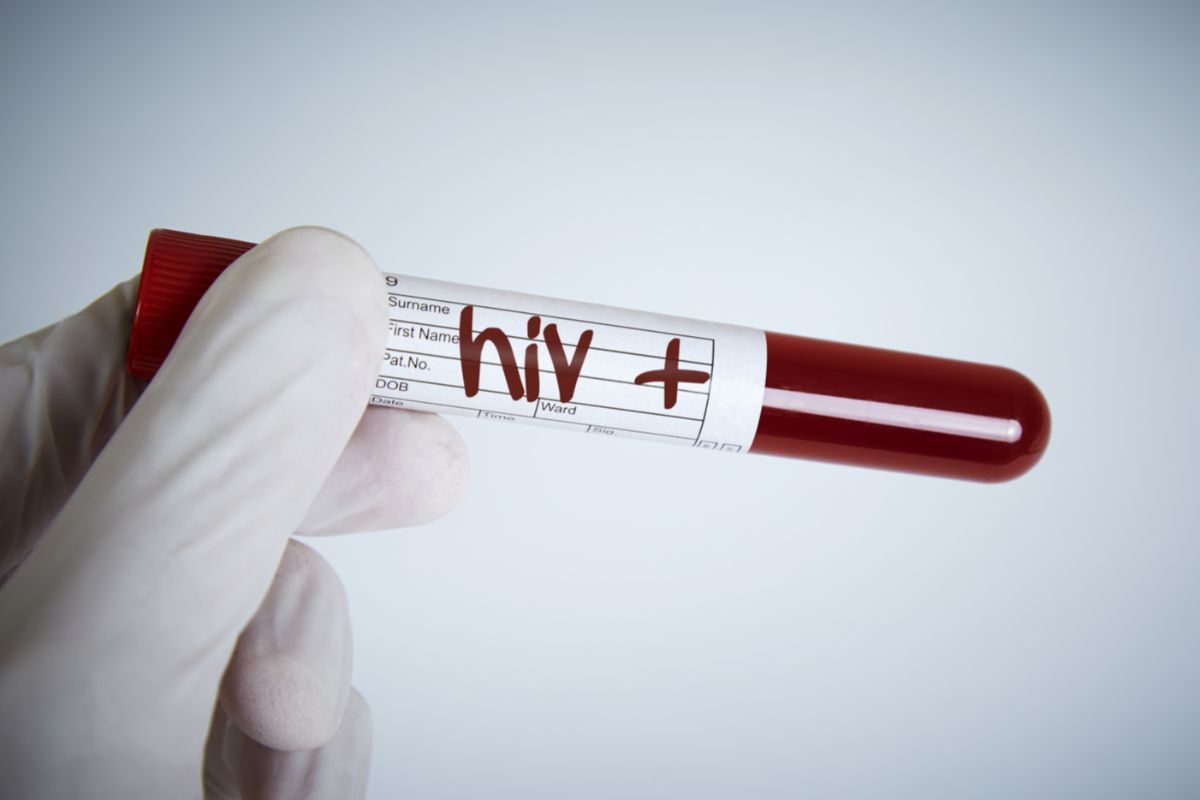 HIV: Treatment Options And Managing Symptoms