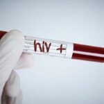 What Are The Main Symptoms Of HIV?