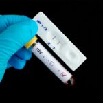 When Is A HIV Test Conclusive? Everything That You Need To Know