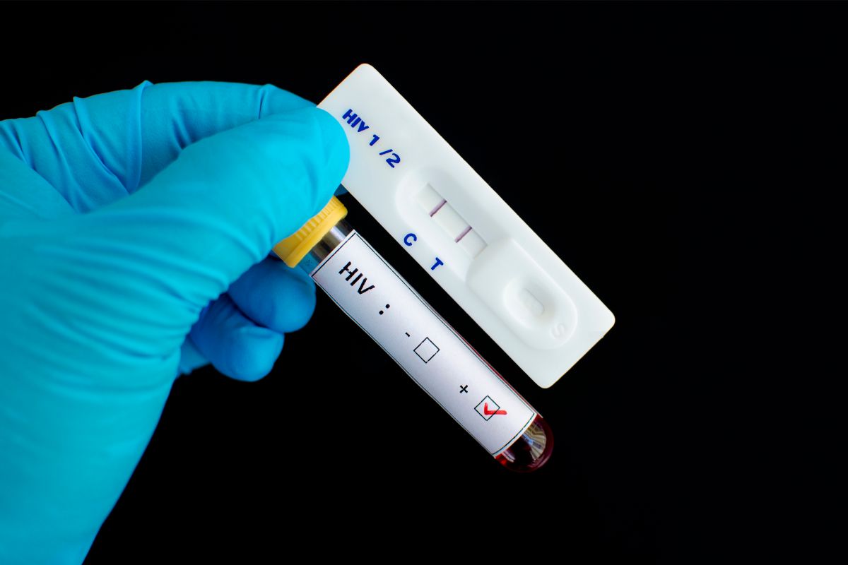 When Is A HIV Test Conclusive? [Everything That You Need To Know]