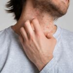 Why-You-Shouldnt-Ignore-Your-Eczema-Best-Treatment-Options